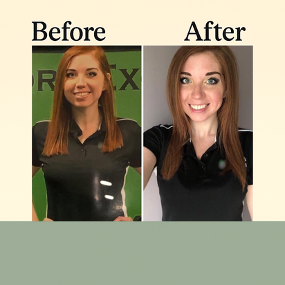 Aloura Lymphatic Drainage Supplement